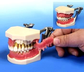PERIODONTAL MOELS FOR  PATIENTS DEMONSTRATION HELPS PRACTICE BUILD WITH FULL PATIENTS CONFIDENCE