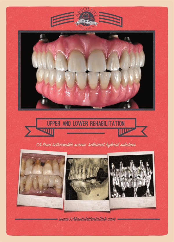 Upper and Lower Rehabilitation