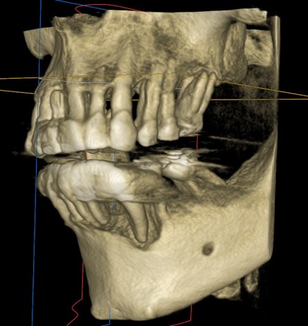 Upper and Lower Rehabilitation