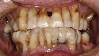 Upper and Lower Rehabilitation