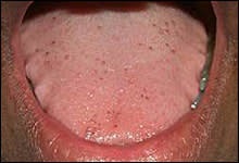 Want more sleep apnea patients....you have them as your general dental patients.  See the clinical signs of  sleep apnea