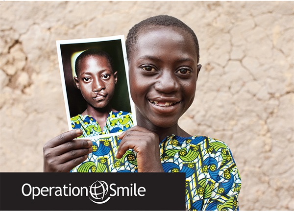 Operation Smile