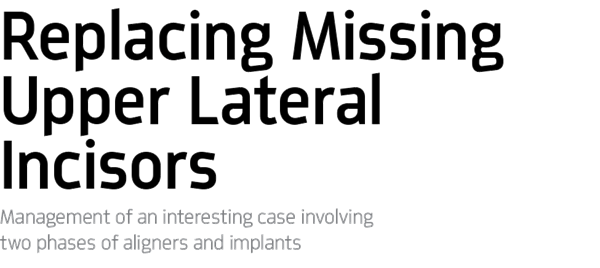 Dentaltown UK Magazine: Show Your Work - Replacing Missing Upper Lateral Incisors
