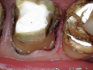 Dentaltown case study