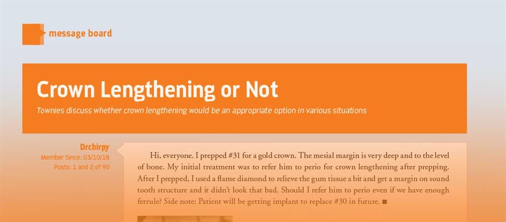 Crown Lengthening or Not