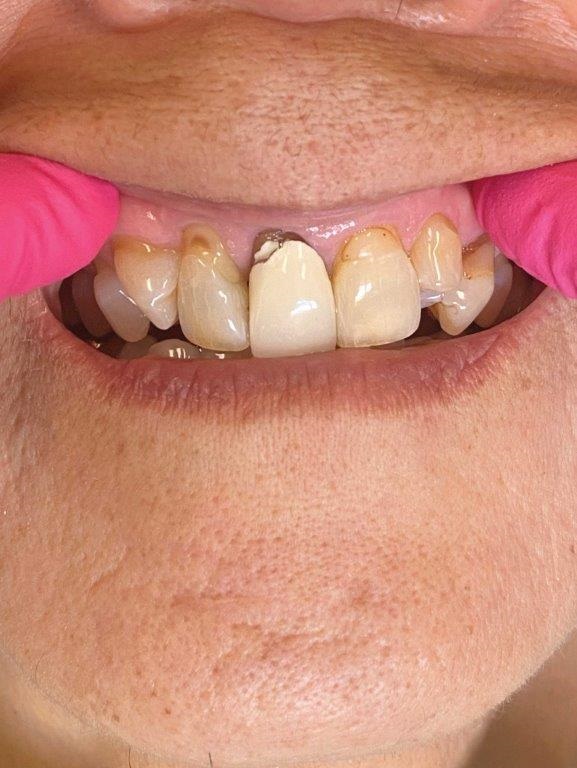 In-house dental lab