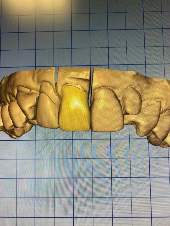 In-house dental lab