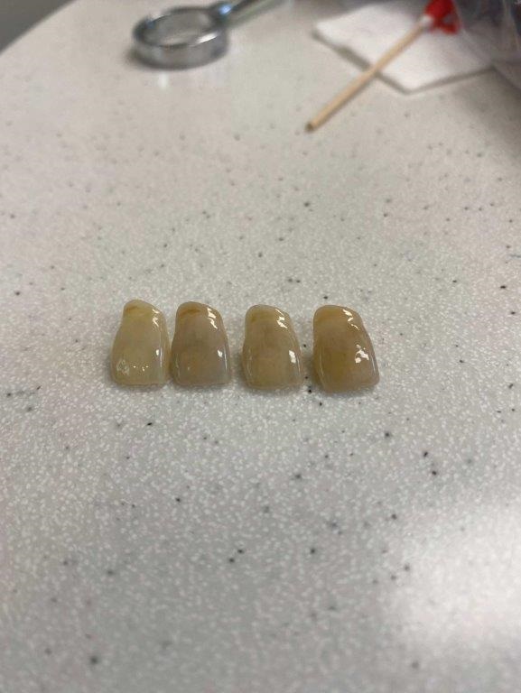 In-house dental lab