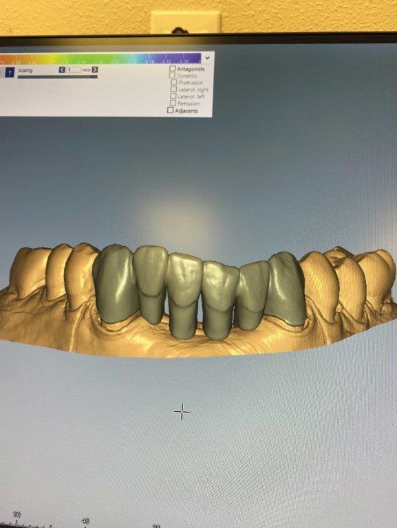 In-house dental lab