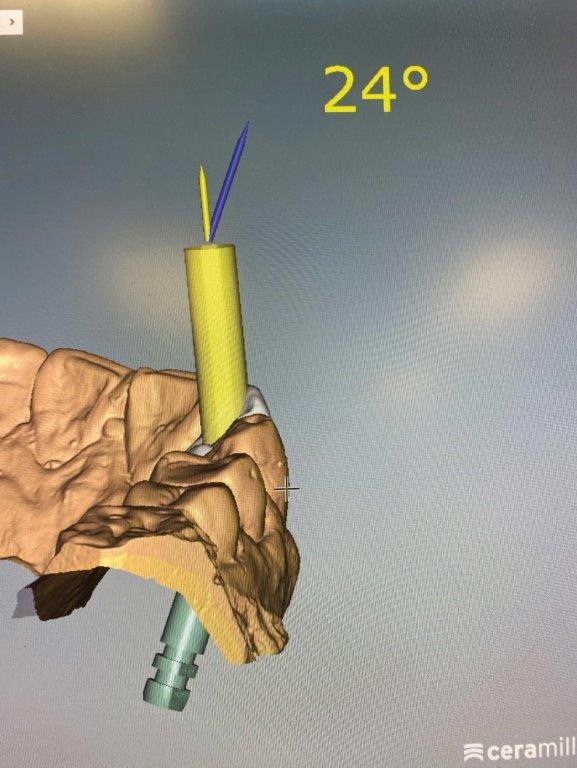 In-house dental lab