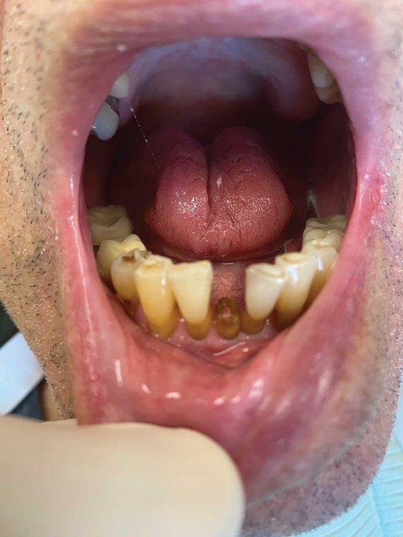In-house dental lab