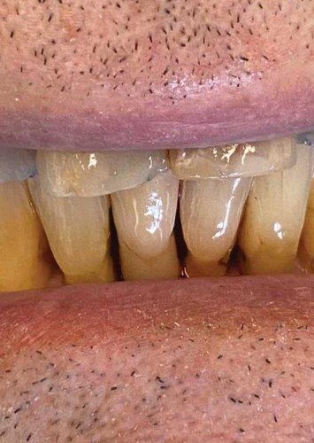In-house dental lab