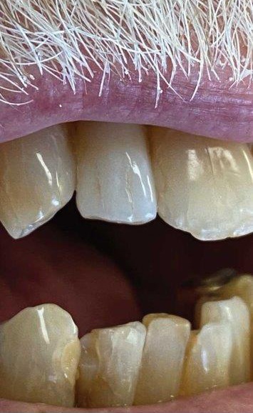 In-house dental lab