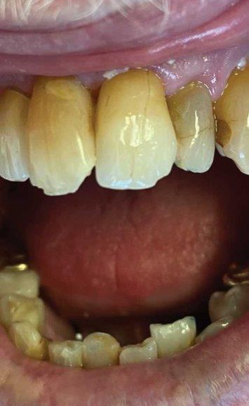 In-house dental lab