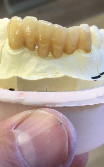 In-house dental lab