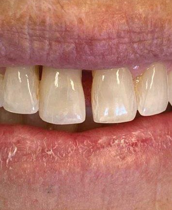 In-house dental lab