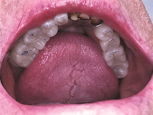 Townie Casefile: Breathing New Life Into a 20-Year-Old RPD