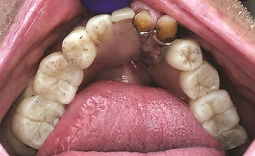 Townie Casefile: Breathing New Life Into a 20-Year-Old RPD