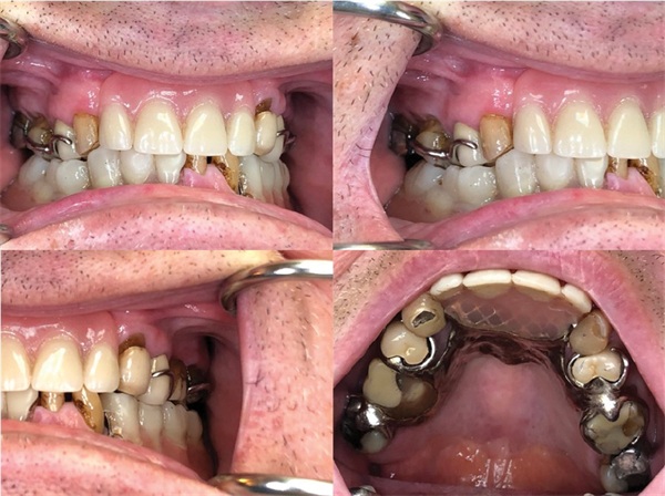 Townie Casefile: Breathing New Life Into a 20-Year-Old RPD