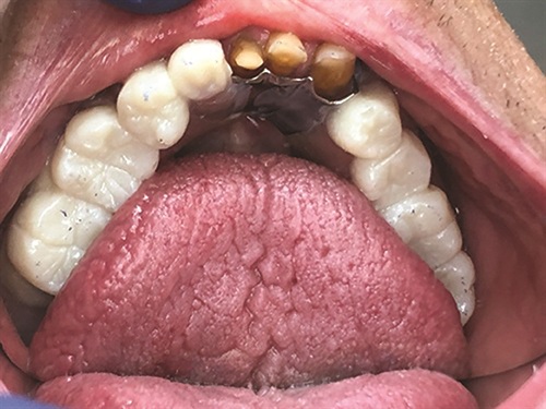 Townie Casefile: Breathing New Life Into a 20-Year-Old RPD