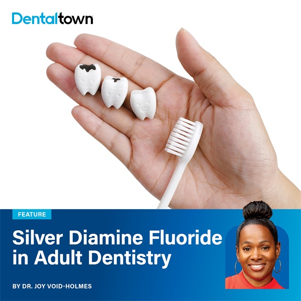 Silver Diamine Fluoride in Adult Dentistry