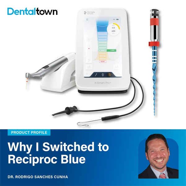 Why I Made the Switch: Reciproc Blue
