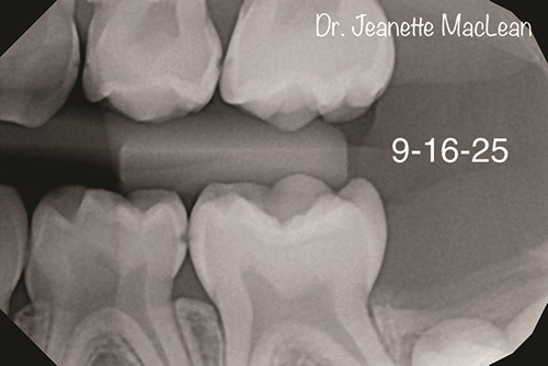 Using AI for Good, Not Evil