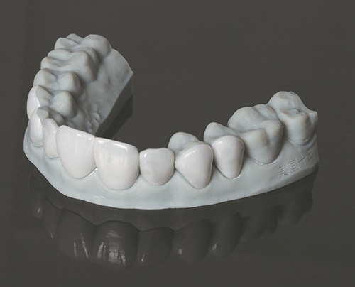 Masking Lifelong Tetracycline Staining