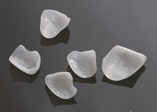 Masking Lifelong Tetracycline Staining