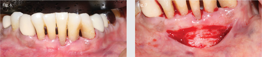 Figs 6-7