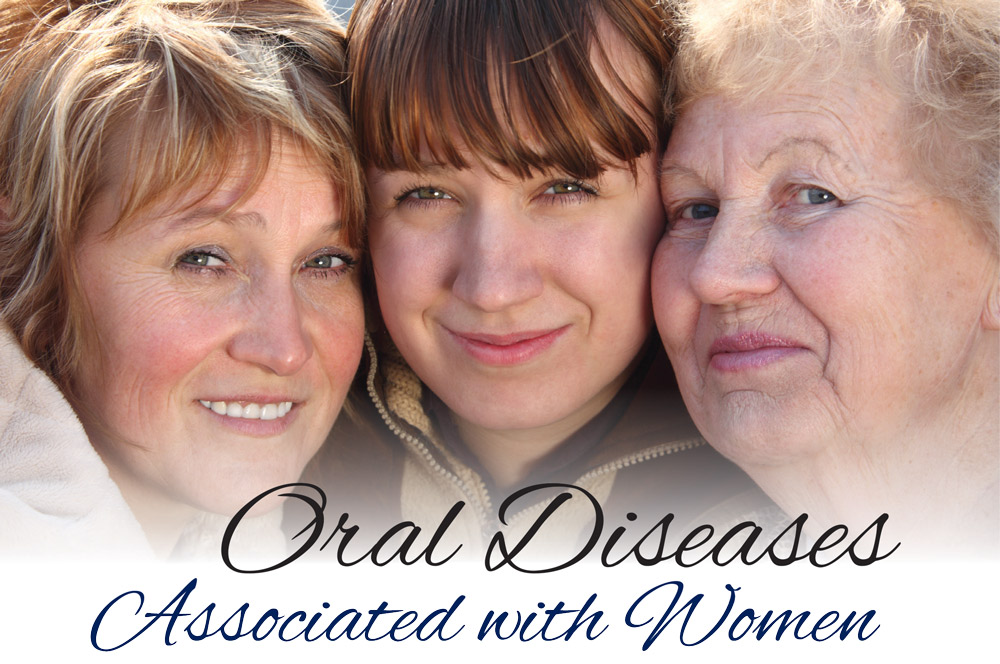 Oral Diseases Associated with Women