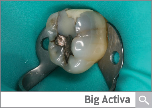 Case Presentation: Big Activa