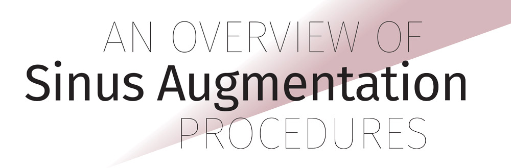 Header: An Overview of Sinus Augmentation Procedures