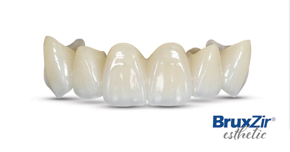 Product Profile: BruxZir Esthetic Zirconia