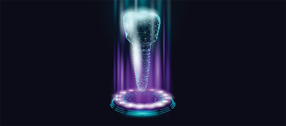 Innovative Techniques in Implantology