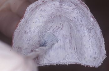 CE: Delivering Successful Complete Dentures