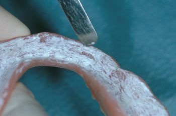 CE: Delivering Successful Complete Dentures