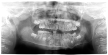 The Puck Stopped Here