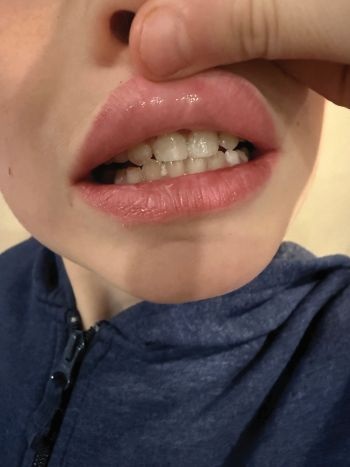 The Puck Stopped Here