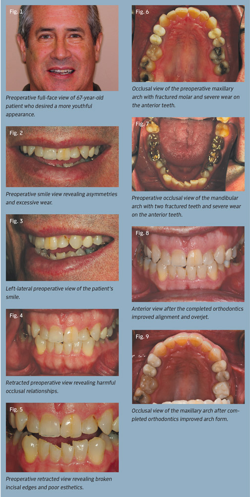 Figs. 1-9