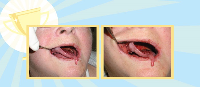 'My Worst Mouth' Contest Results
