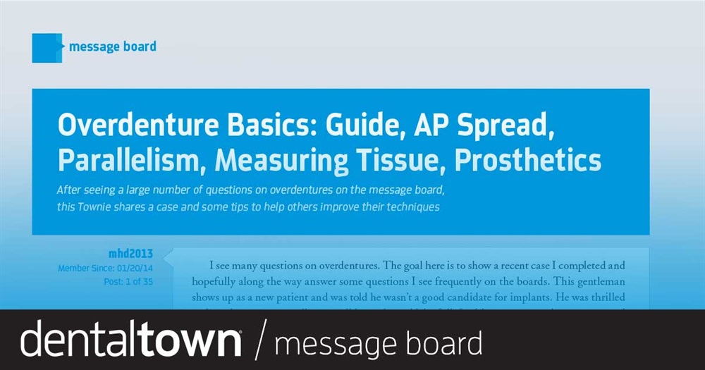 Overdenture Basics: Guide, AP Spread, Parallelism, Measuring Tissue, Prosthetics