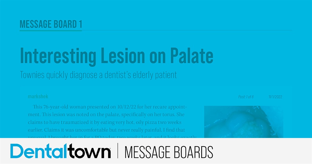 Interesting Lesion on Palate