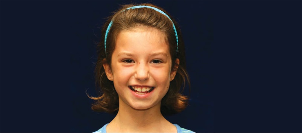 Airway Focused Orthodontics