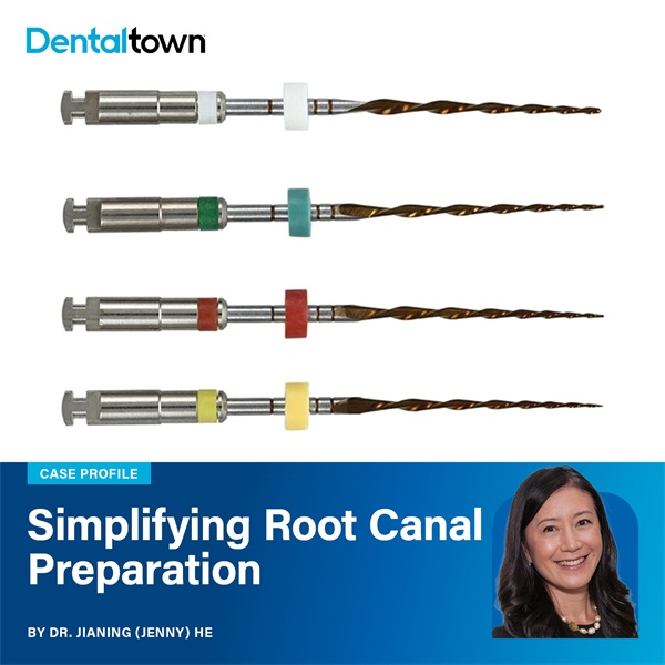 Case Profile: Simplifying Root Canal Preparation