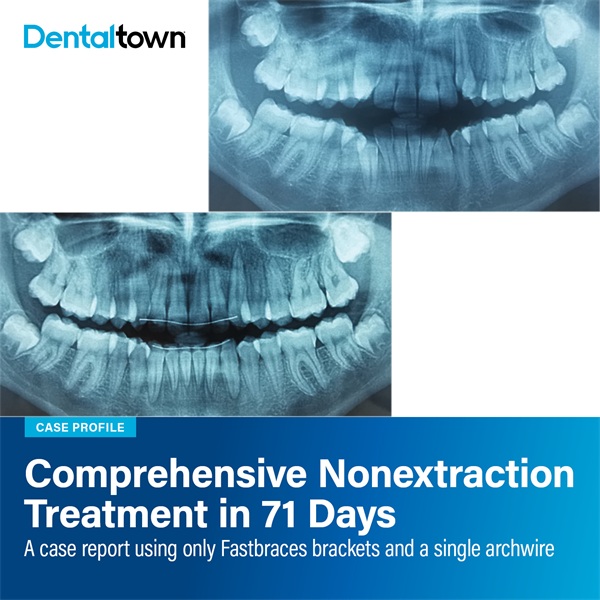 Case Profile: Fastbraces