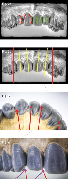 Figs. 2a, 2b, 3, 4