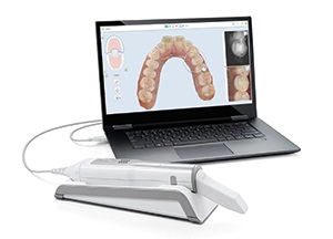 MyiTero.com