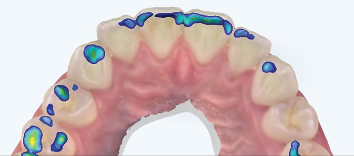 Show Your Work: Dental Restorations — Building Better Bonds 