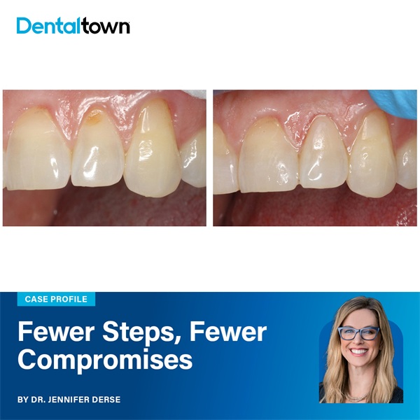 Fewer Steps, Fewer Compromises